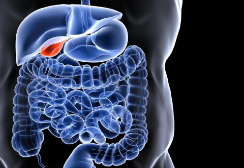 Mối liên quan giữa béo phì và sỏi túi mật